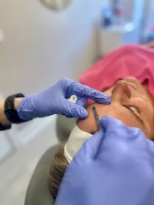 Female patient receiving dermaplaning treatment by Direct Aesthetics medical provider