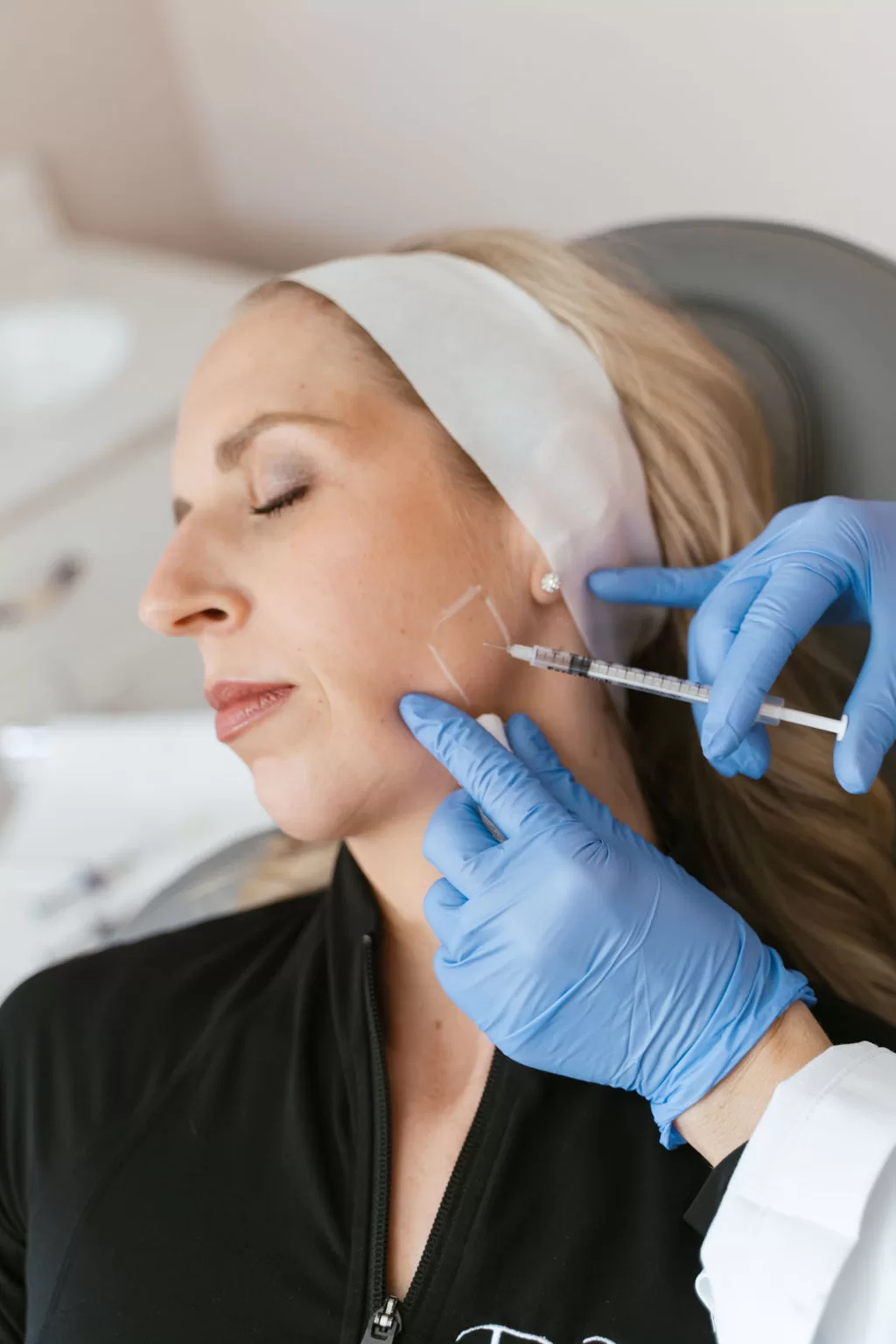 female patient receiving jawline filler