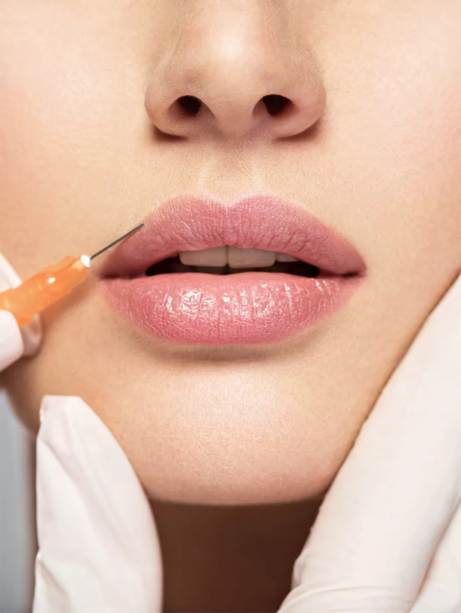 female receiving lip filler