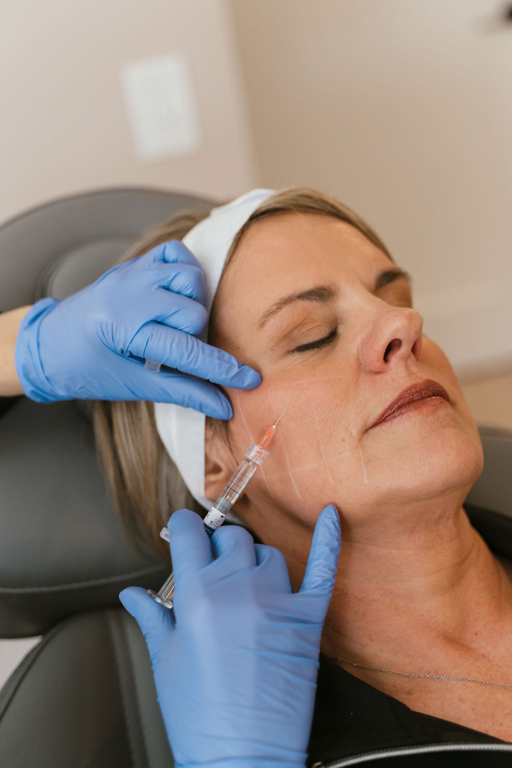 female patient receiving midface filler injection