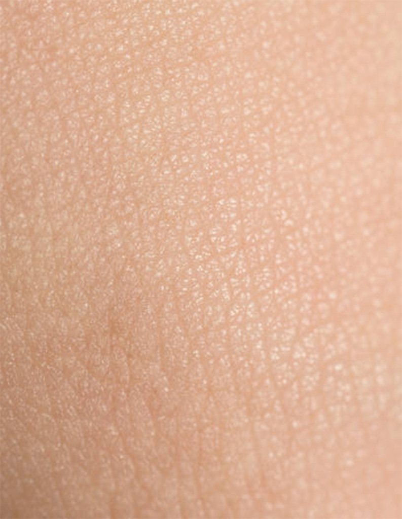 A close up image of normal skin.