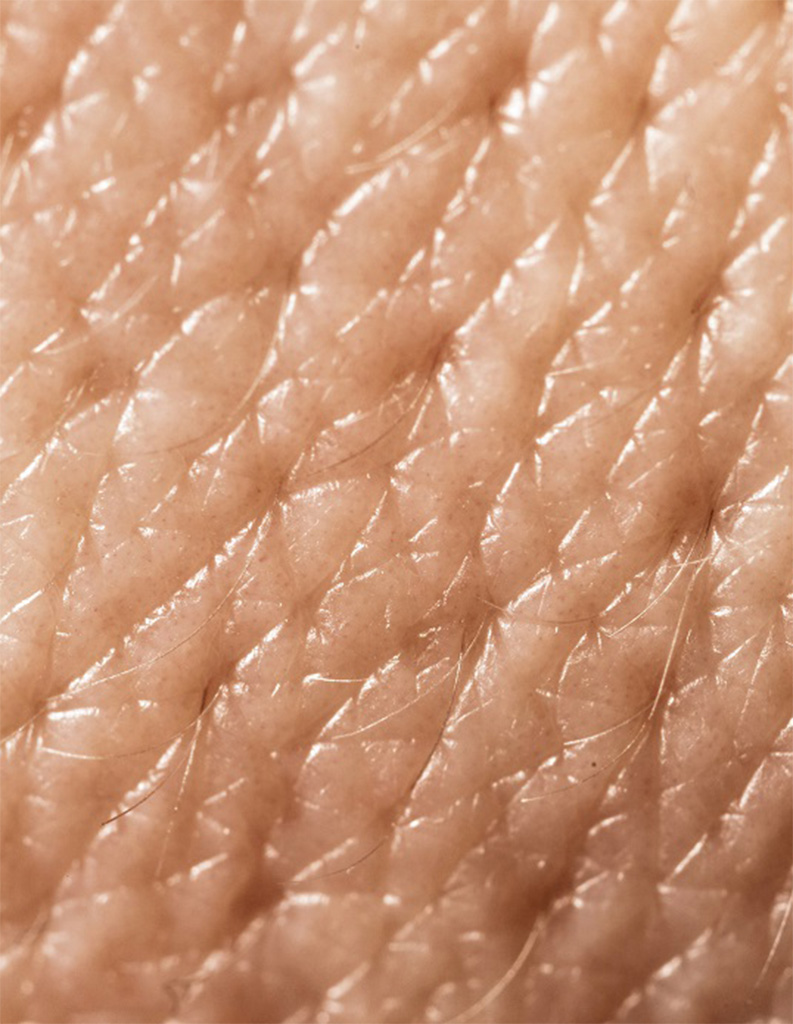 A close up image of oily skin