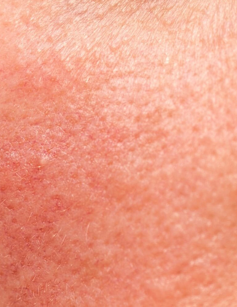 A close up image of sensitive skin